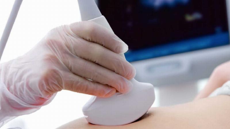 Hình ảnh một màn hình siêu âm cho thấy rõ túi thai và phôi thai bên trong tử cung của chó mẹ, minh họa phương pháp chẩn đoán mang thai bằng siêu âm.